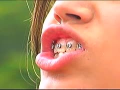 Das Mädchen mit der Zahnspange steht auf Hardcore Sex